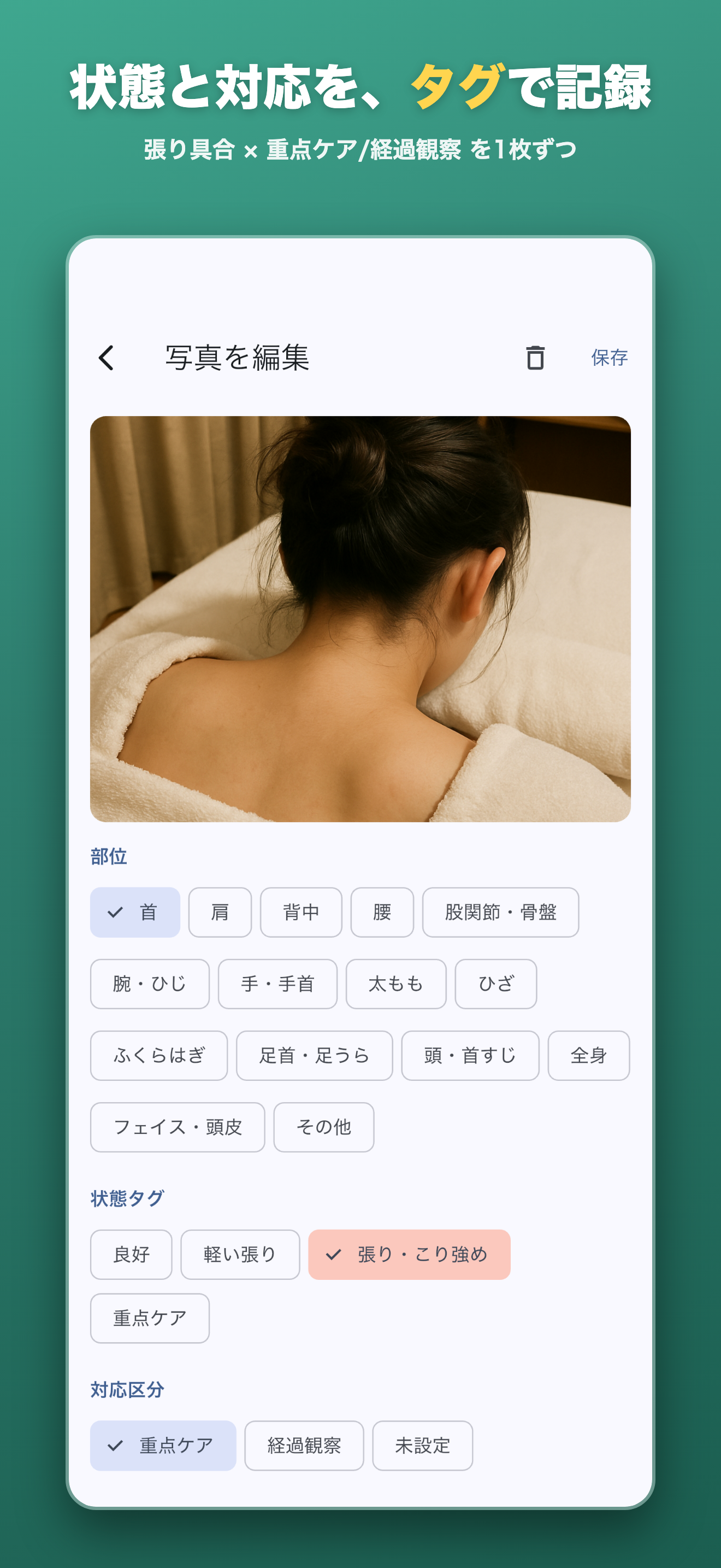 状態と対応を、タグで記録。張り具合 × 重点ケア/経過観察 を1枚ずつ